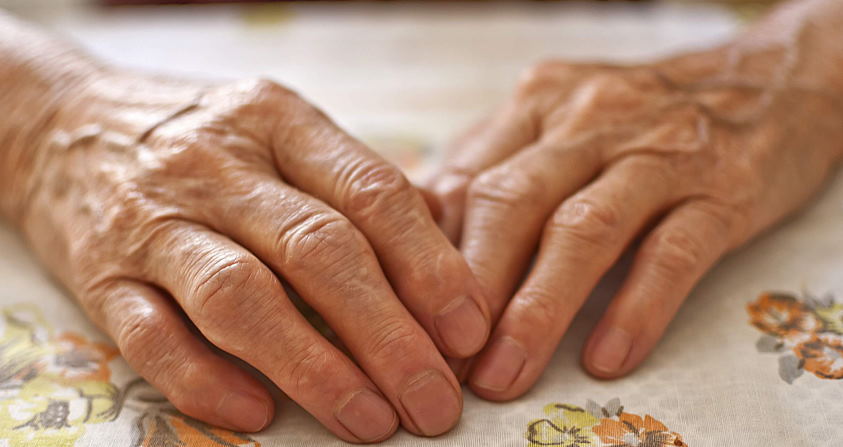 aging hands