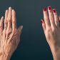 What Is the Best Treatment for Aging Hands?